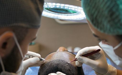 How Much Does a Hair Transplant Cost?